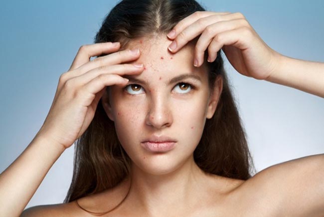 Giải đáp thắc mắc người bị thủy đậu kiêng ăn gì để hạn chế sẹo lõm