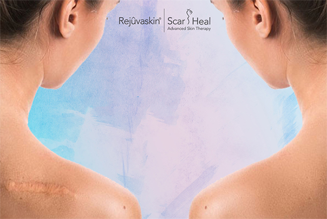 Gel làm mờ sẹo Scar Rejuvasil sử dụng có hiệu quả không? Có ai dùng chưa?