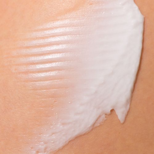 Kem phòng ngừa và làm mờ rạn da Stretch Mark