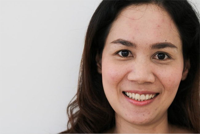 Seo-lom-gay-mat-tham-my-cho-nhieu-nguoi