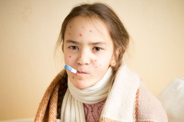 nguoi-bi-benh-thuy-dau-can-kieng-an-gi