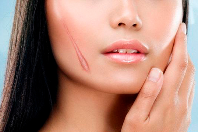 Rejuvasil làm mờ sẹo có thật sự tốt không? Có hiệu quả như quảng cáo không?