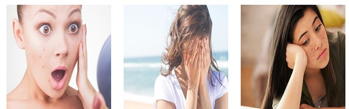 Cuộc sống chỉ là một màu đen khi những vết sẹo loang lổ, xấu xí không buông tha bạn