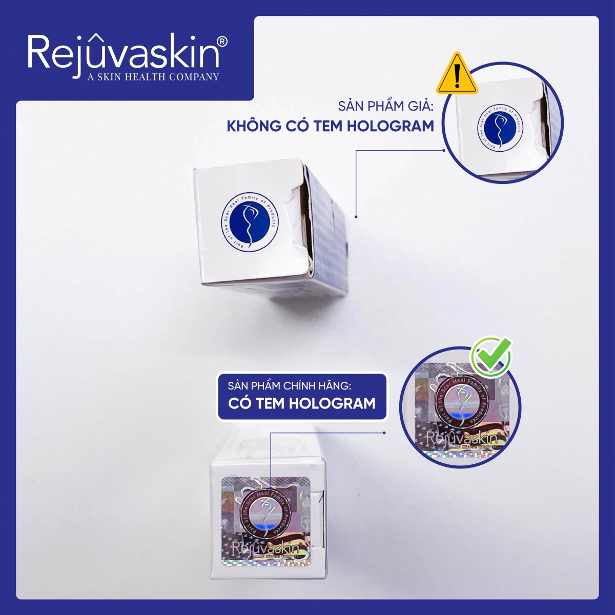 tem hologram nhận diện chính hãng kem làm mờ sẹo thâm rỗ lõm Scar Esthetique