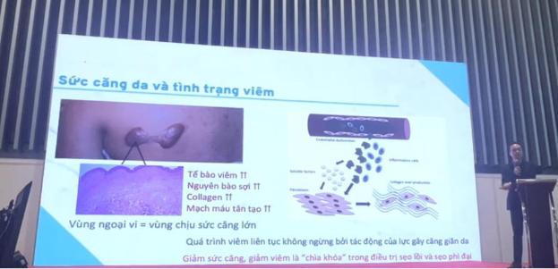 Nguyên nhân dẫn đến sẹo lồi, phì đại