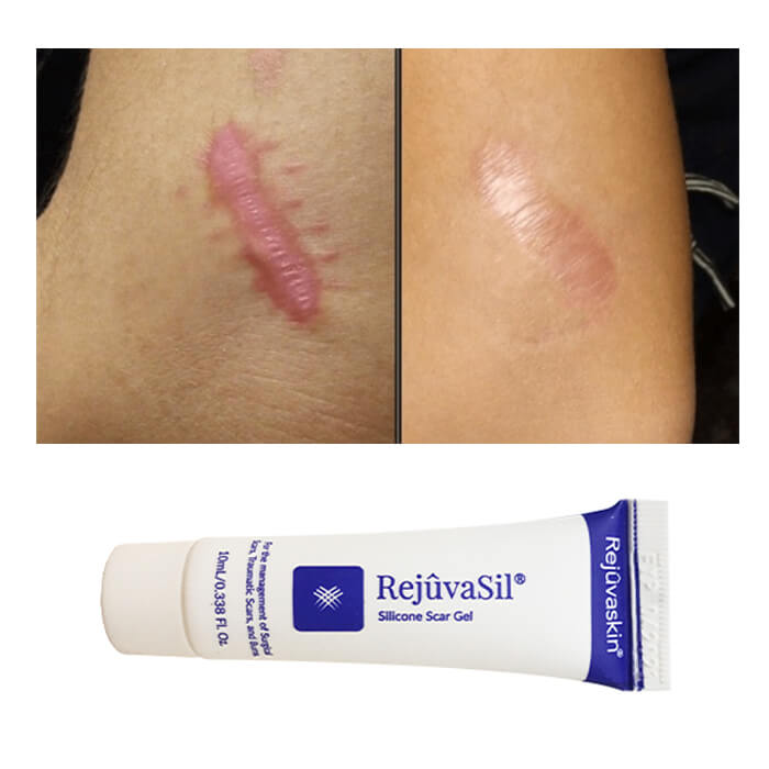 Sử dụng như thế nào cho hiệu quả dưỡng da là tốt nhất Sử dụng như thế nào cho hiệu quả dưỡng da là tốt nhất