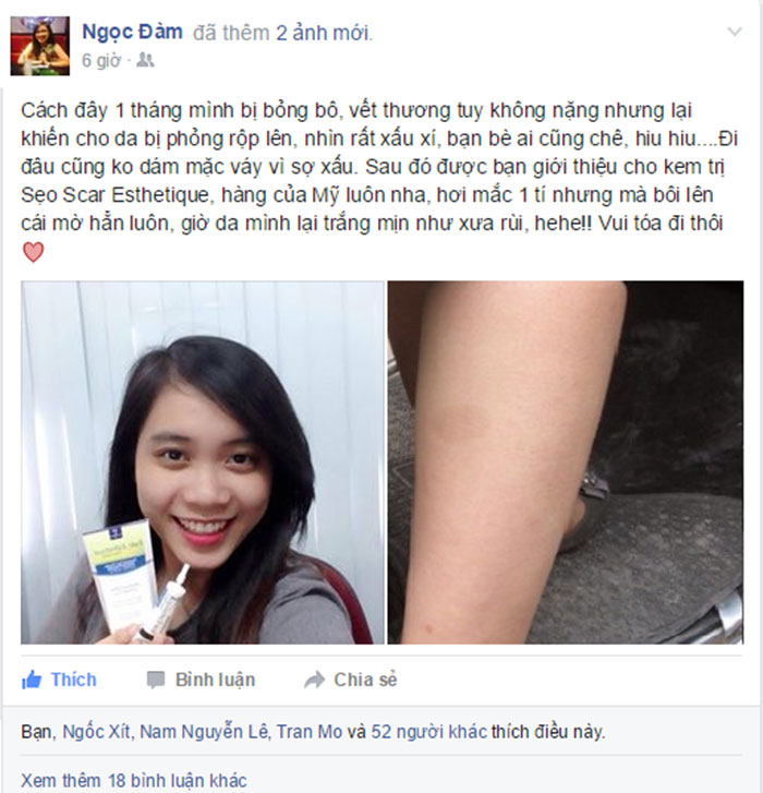 Bạn Ngọc Đàm tin tưởng sử dụng Esthetique và nhanh chóng lấy lại sự tự tin cho bản thân