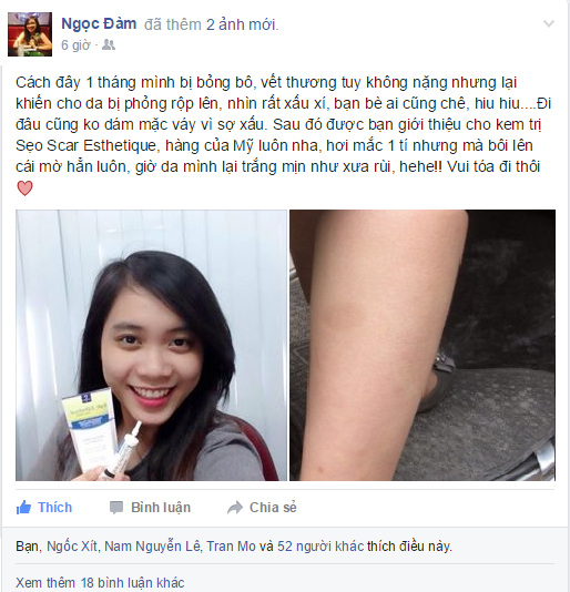 Mọi nỗi lo lắng về vết sẹo thâm do bỏng bô của bạn Ngọc Đàm đã được Scar Esthetique dứt điểm hiệu quả  Mọi nỗi lo lắng về vết sẹo thâm do bỏng bô của bạn Ngọc Đàm đã được Scar Esthetique dứt điểm hiệu quả