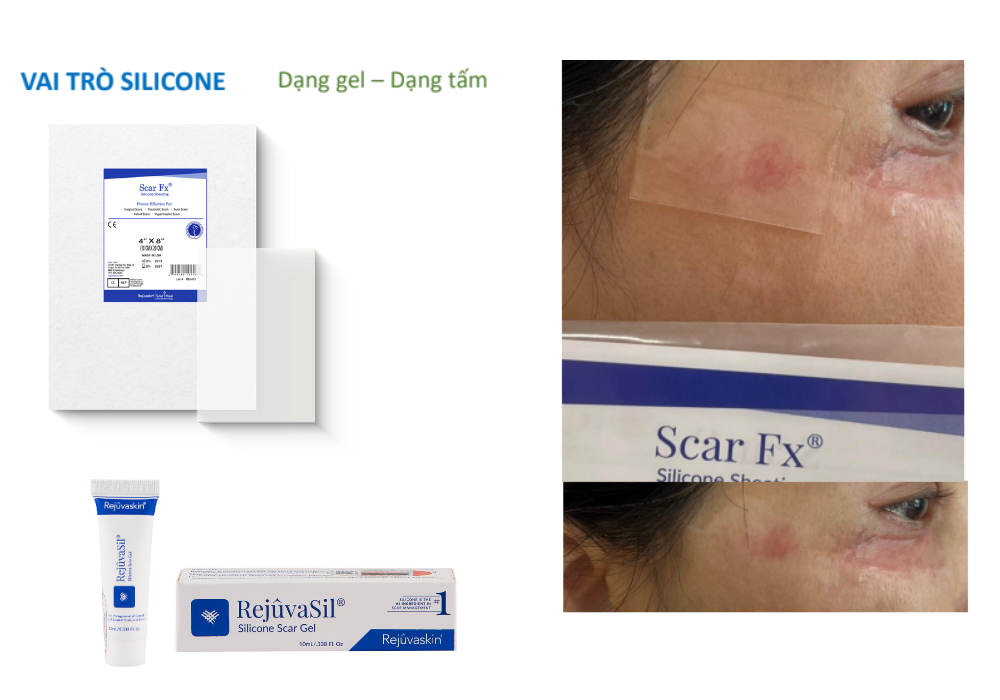 Vài trò của silicone trong làm mờ sẹo