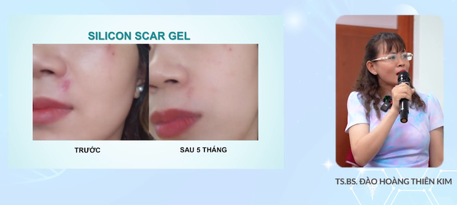 Hiệu quả của silicone làm mờ sẹo dạng gel