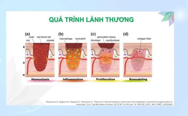 Quá trình lành thương diễn ra như thế nào?