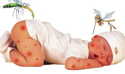 Sẹo thâm trên cơ thể bé là một điều đáng lo ngại Sẹo thâm trên cơ thể bé là một điều đáng lo ngại