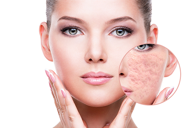 Thuốc làm mờ sẹo Scar Esthetique sử dụng có hiệu quả không?