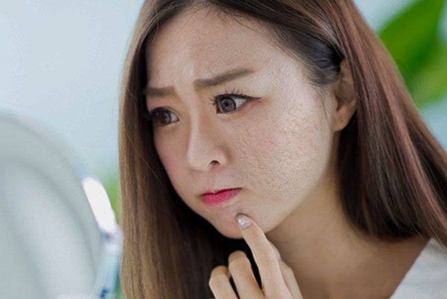 Tổng hợp các cách làm mờ sẹo hiệu quả nhất năm 2019