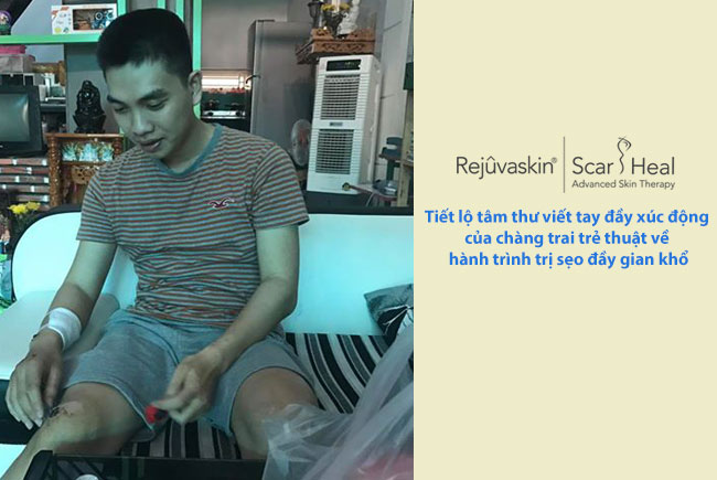 Tiết lộ tâm thư viết tay đầy xúc động của chàng trai trẻ thuật về hành trình làm mờ sẹo đầy gian khổ