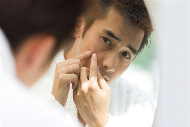 Lấp đầy sẹo thâm, sẹo rỗ do mụn giúp phái mạnh tự tin và manly hơn