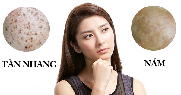 Phụ nữ trên 30 thường gặp phải rất nhiều vấn đề xấu về da Phụ nữ trên 30 thường gặp phải rất nhiều vấn đề xấu về da