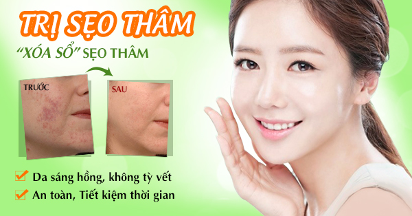  Không thể phủ nhận hiệu quả trị sẹo thâm mụn mà Scar Heal Esthetique đã mang lại